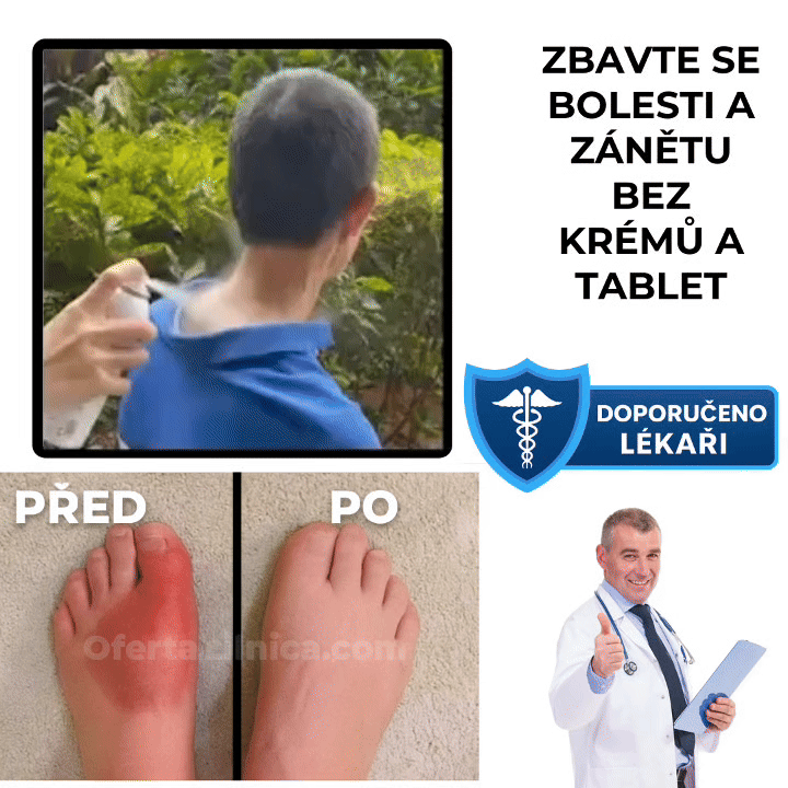 RapidCool™ sprej pro zmírnění bolesti