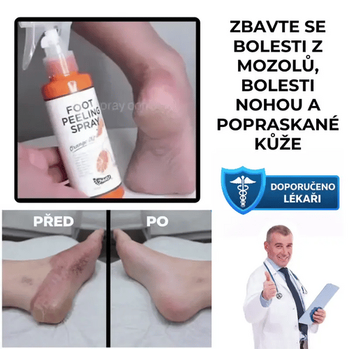 Exfoliační sprej na chodidla – FootFresh™
