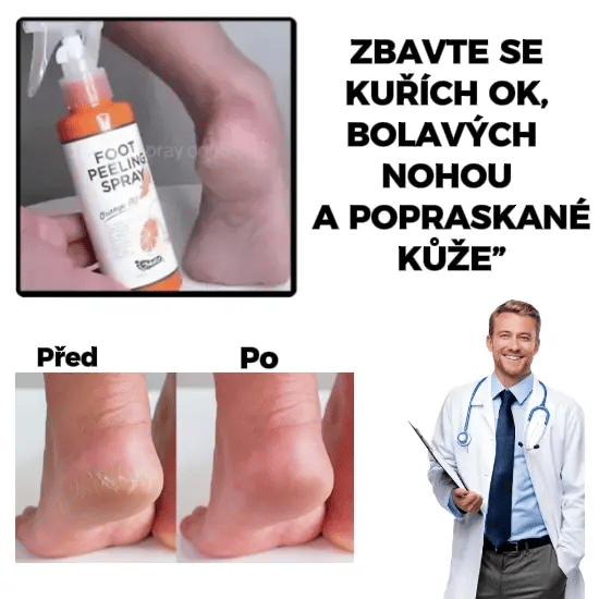 Exfoliační sprej FootFresh™