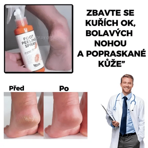 Exfoliační sprej FootFresh™