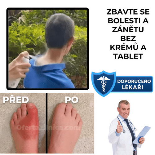 RapidCool™ sprej pro zmírnění bolesti